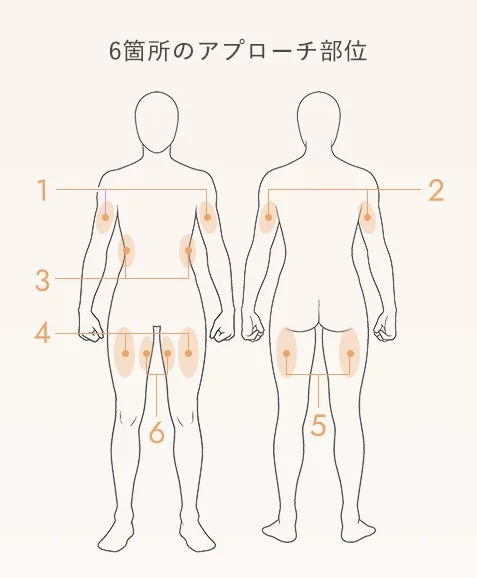 アプローチ部位